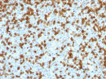 PDCD1 / PD1 / CD279 (Programmed Cell Death 1) Antibody