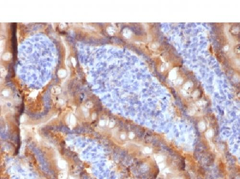 MRP1 / ABCC1 Antibody