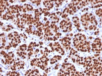 FOXA1 / HNF3A Antibody