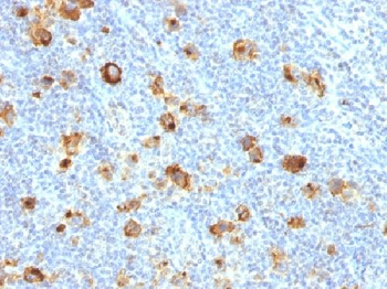 CD15 / FUT4 (Reed-Sternberg Cell Marker) Antibody