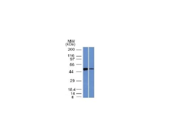 ALDH1A1 (Aldehyde Dehydrogenase 1A1) Antibody
