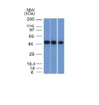 NSE gamma Antibody