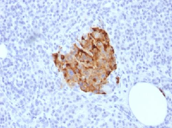 Chromogranin A / CHGA Antibody
