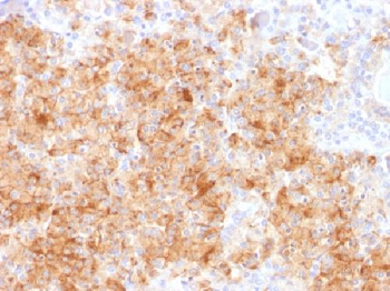 Chromogranin A / CHGA Antibody