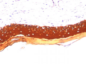 Cytokeratin, Acidic (Type I or LMW) (Epithelial Marker) Antibody - With BSA and Azide