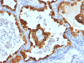 Cytokeratin 8/18 Antibody - With BSA and Azide
