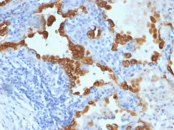 Cytokeratin 8/18 Antibody - With BSA and Azide
