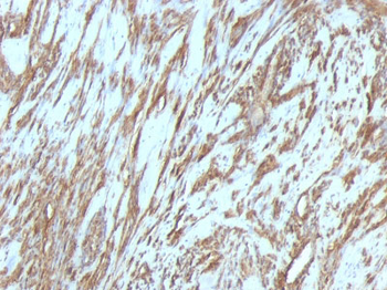 Actin, Muscle Specific (Muscle Cell Marker) Antibody - With BSA and Azide