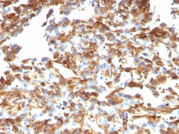 Vimentin (Mesenchymal Cell Marker) Antibody - With BSA and Azide
