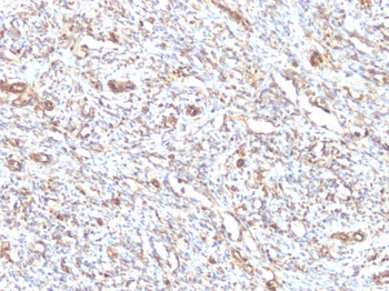 Vimentin (Mesenchymal Cell Marker) Antibody - With BSA and Azide