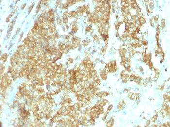 GRP94 / HSP90B1 (Endoplasmic Reticulum Marker) Antibody - With BSA and Azide
