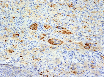 TNF-alpha (Tumor Necrosis Factor alpha) Antibody - With BSA and Azide