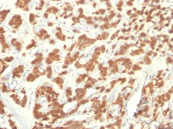 Cytokeratin 18 (KRT18) Antibody - With BSA and Azide