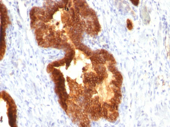 Cytokeratin 18 (KRT18) Antibody - With BSA and Azide