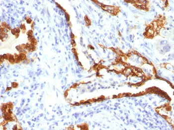 Cytokeratin 18 (KRT18) Antibody - With BSA and Azide