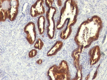 Cytokeratin 18 (KRT18) Antibody - With BSA and Azide