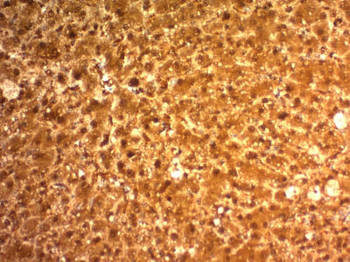 Arginase 1 (Hepatocellular Carcinoma Marker) Antibody - With BSA and Azide