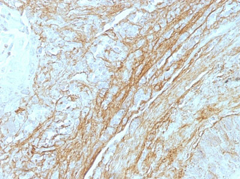 Tenascin C (Stromal Marker For Epithelial Malignancy) Antibody - With BSA and Azide