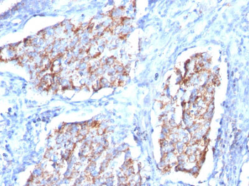 HSP60 (Heat Shock Protein 60) (Mitochondrial Marker) Antibody - With BSA and Azide