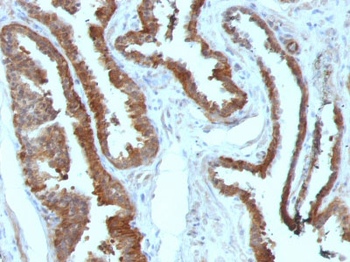 HSP27 (Heat Shock Protein 27) Antibody - With BSA and Azide