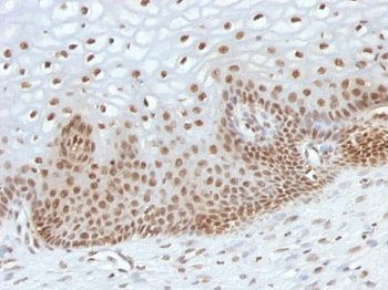 TOX3 / TNRC9 Antibody - With BSA and Azide