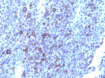 Glypican-3 (GPC3) (Hepatocellular Carcinoma Marker) Antibody - With BSA and Azide