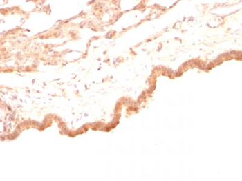 Glypican-3 (GPC3) (Hepatocellular Carcinoma Marker) Antibody - With BSA and Azide