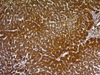 Glypican-3 (GPC3) (Hepatocellular Carcinoma Marker) Antibody - With BSA and Azide