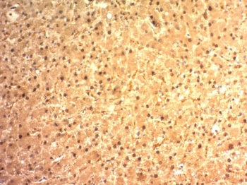 Glypican-3 (GPC3) (Hepatocellular Carcinoma Marker) Antibody - With BSA and Azide