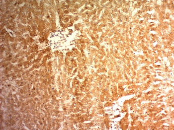 Glypican-3 (GPC3) (Hepatocellular Carcinoma Marker) Antibody - With BSA and Azide