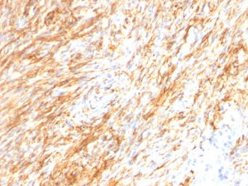 GFAP (Astrocyte & Neural Stem Cell Marker) Antibody - With BSA and Azide