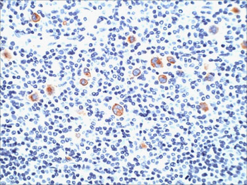 CD15 / FUT4 (Reed-Sternberg Cell Marker) Antibody - With BSA and Azide