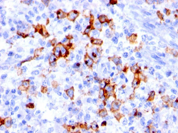 CD15 / FUT4 (Reed-Sternberg Cell Marker) Antibody - With BSA and Azide