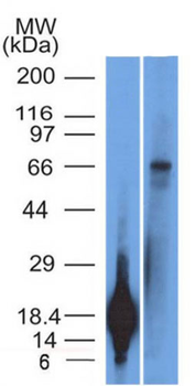 TRIM29 (Lung Squamous Cell Carcinoma Marker) Antibody - With BSA and Azide