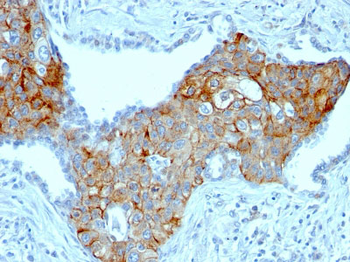 TRIM29 (Lung Squamous Cell Carcinoma Marker) Antibody - With BSA and Azide