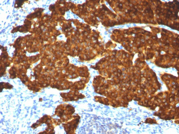 Chromogranin A / CHGA (Neuroendocrine Marker) Antibody - With BSA and Azide