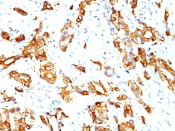 HSP27 (Heat Shock Protein 27) Antibody - With BSA and Azide