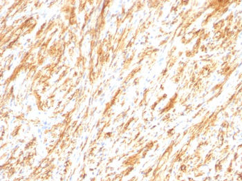 GFAP (Astrocyte & Neural Stem Cell Marker) Antibody - With BSA and Azide