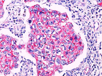 beta-Catenin (p120) Antibody - With BSA and Azide