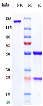 Zaire Ebola virus Reference Antibody (Cosfroviximab)
