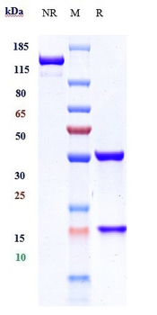 CA9 / CAIX Reference Antibody (girentuximab-MMAE)