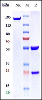 VEGFR2 / KDR / CD309 Reference Antibody (AT001)