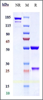 ALCAM / CD166 Reference Antibody (AT002)