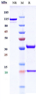 PCSK9 Reference Antibody (lodelcizumab)