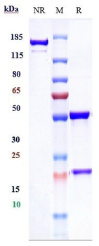DCBLD2 / ESDN Reference Antibody (FA19-1)