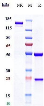 EpCAM / TROP1 / CD326 Reference Antibody (Tucotuzumab)