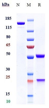 CD20 Reference Antibody (obinutuzumab)