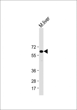 IL1RAP Antibody (Center)