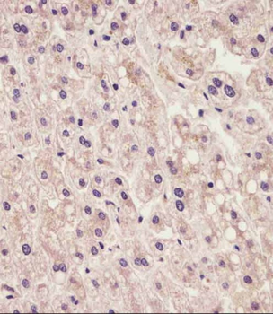 IL1RAP Antibody (Center)