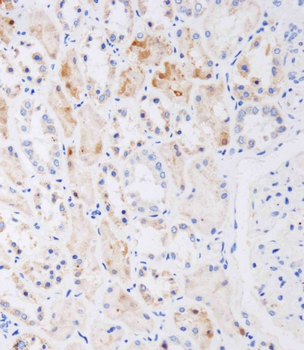 NAT8L Antibody (N-Term)